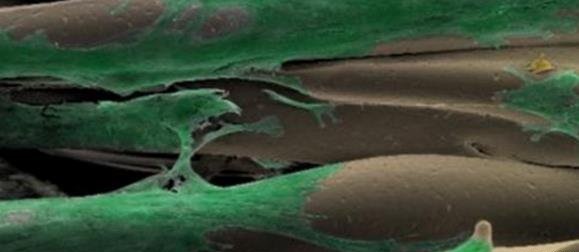 3D����������ҽ������İ˴�ϣ����һ��